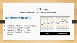 Instrumentos de vigilancia trabajo de parto.pptx