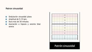Patron sinusoidal
● Ondulación sinusoidal plana
● Amplitud de 5−15 lpm.
● Dura más de 30 minutos
● Asociación a hipoxia y anemia fetal
severa
 
