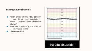 Patron pseudo sinusoidal
● Patrón similar al sinusoidal, pero con
una forma más angulada y
picuda similar a unos “dientes de
tiburón”
● Suele ser precedido y continuar por
un registro normal
● Hipotensión fetal
 