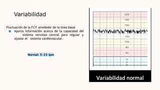 Variabilidad
Fluctuación de la FCF alrededor de la línea basal
● Aporta información acerca de la capacidad del
sistema nervioso central para regular y
ajustar el sistema cardiovascular.
Normal: 5–25 lpm
 