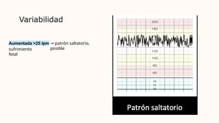 Variabilidad
Aumentada >25 lpm → patrón saltatorio,
posible
sufrimiento
fetal
 