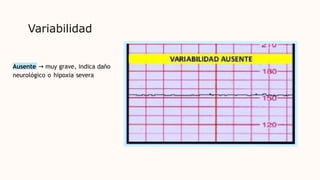 Variabilidad
Ausente → muy grave, indica daño
neurológico o hipoxia severa
 