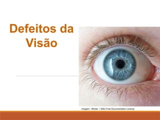 FÍSICA, 2º
Lentes Esféricas
Defeitos da
Visão
Imagem: 8thstar / GNU Free Documentation License
 