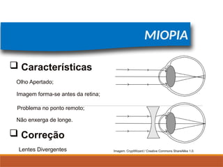 FÍSICA, 2º
Lentes Esféricas
MIOPIA
Olho Apertado;
Imagem forma-se antes da retina;
Problema no ponto remoto;
 Características
 Correção
Lentes Divergentes
Não enxerga de longe.
Imagem: CryptWizard / Creative Commons ShareAlike 1.0.
 
