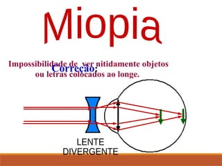 Impossibilidade de ver nitidamente objetos
ou letras colocados ao longe.
Correção:
 