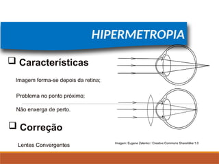 FÍSICA, 2º
Lentes Esféricas
HIPERMETROPIA
Imagem forma-se depois da retina;
Problema no ponto próximo;
 Características
 Correção
Lentes Convergentes
Não enxerga de perto.
Imagem: Eugene Zelenko / Creative Commons ShareAlike 1.0
 