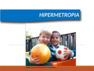 FÍSICA, 2º
Lentes Esféricas
HIPERMETROPIA
Imagem: Governo Federal dos EUA / Public Domain.
 