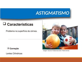 FÍSICA, 2º
Lentes Esféricas
ASTIGMATISMO
Problema na superfície da córnea.
 Características
Lentes Cilíndricas
Imagem: Governo Federal dos EUA / Public Domain.
 Correção
 