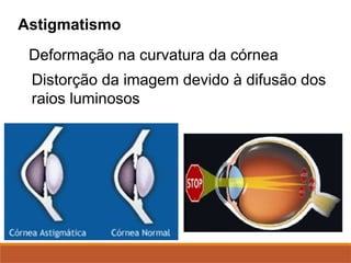 Astigmatismo
Deformação na curvatura da córnea
Distorção da imagem devido à difusão dos
raios luminosos
 