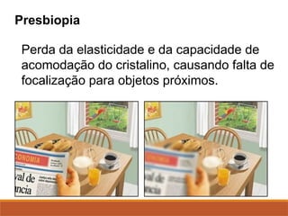 Presbiopia
Perda da elasticidade e da capacidade de
acomodação do cristalino, causando falta de
focalização para objetos próximos.
 