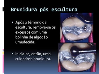Brunidura pós escultura

 Após o término da
  escultura, remove-se os
  excessos com uma
  bolinha de algodão
  umedecida.

 Inicia-se, então, uma
  cuidadosa brunidura.
 