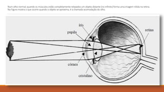 Num olho normal, quando os músculos estão completamenterelaxados um objeto distante (no infinito) forma uma imagem nítida na retina.
Na Figura mostra o que ocorre quando o objeto se aproxima, é a chamada acomodação do olho.
 