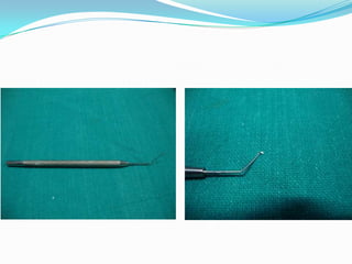 Kelman-McPherson forcepsCharacteristics-These are fine forceps with bent blade.USES-Used to tear off the anterior capsule of lens in cataract surgery.