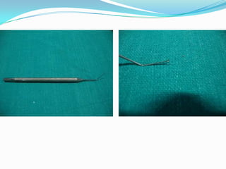 Used to hold the sutures.