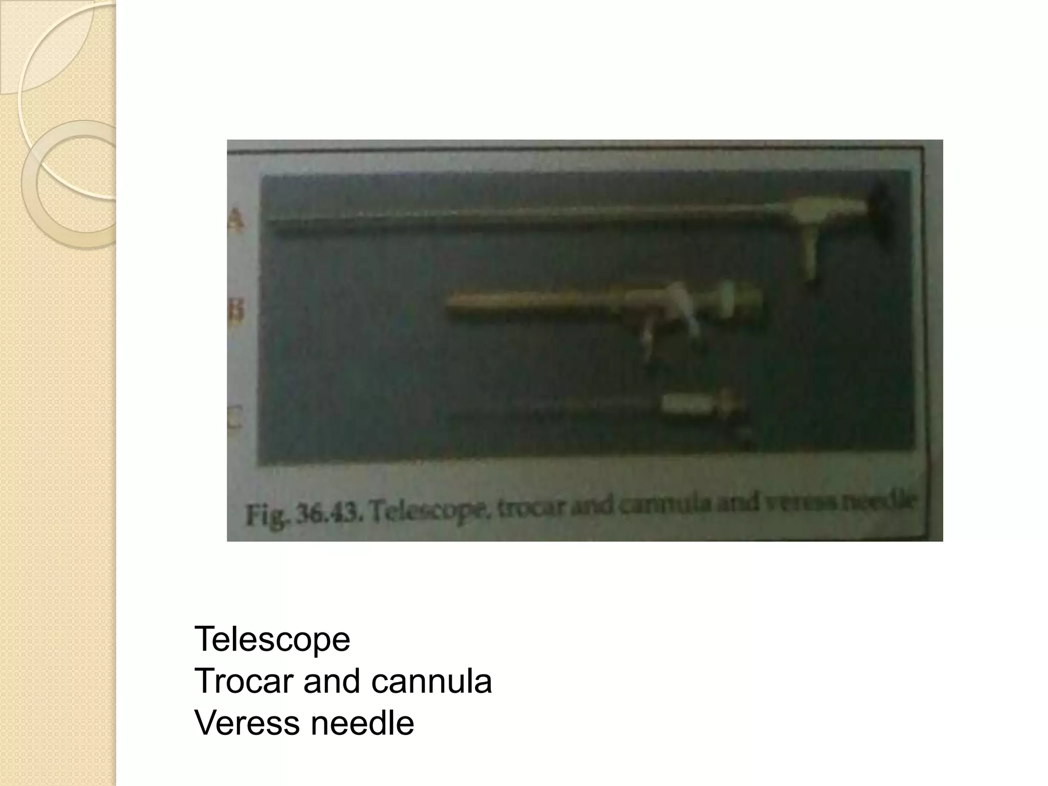 Telescope
Trocar and cannula
Veress needle
 