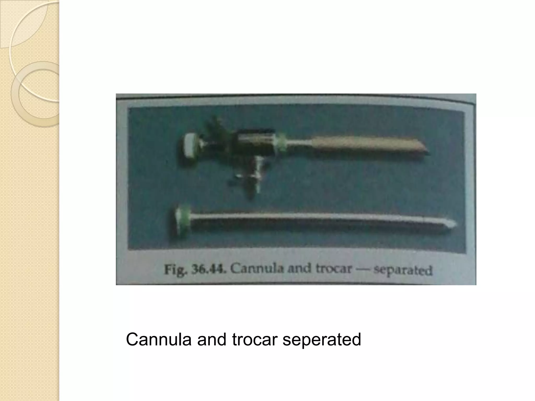 Cannula and trocar seperated
 