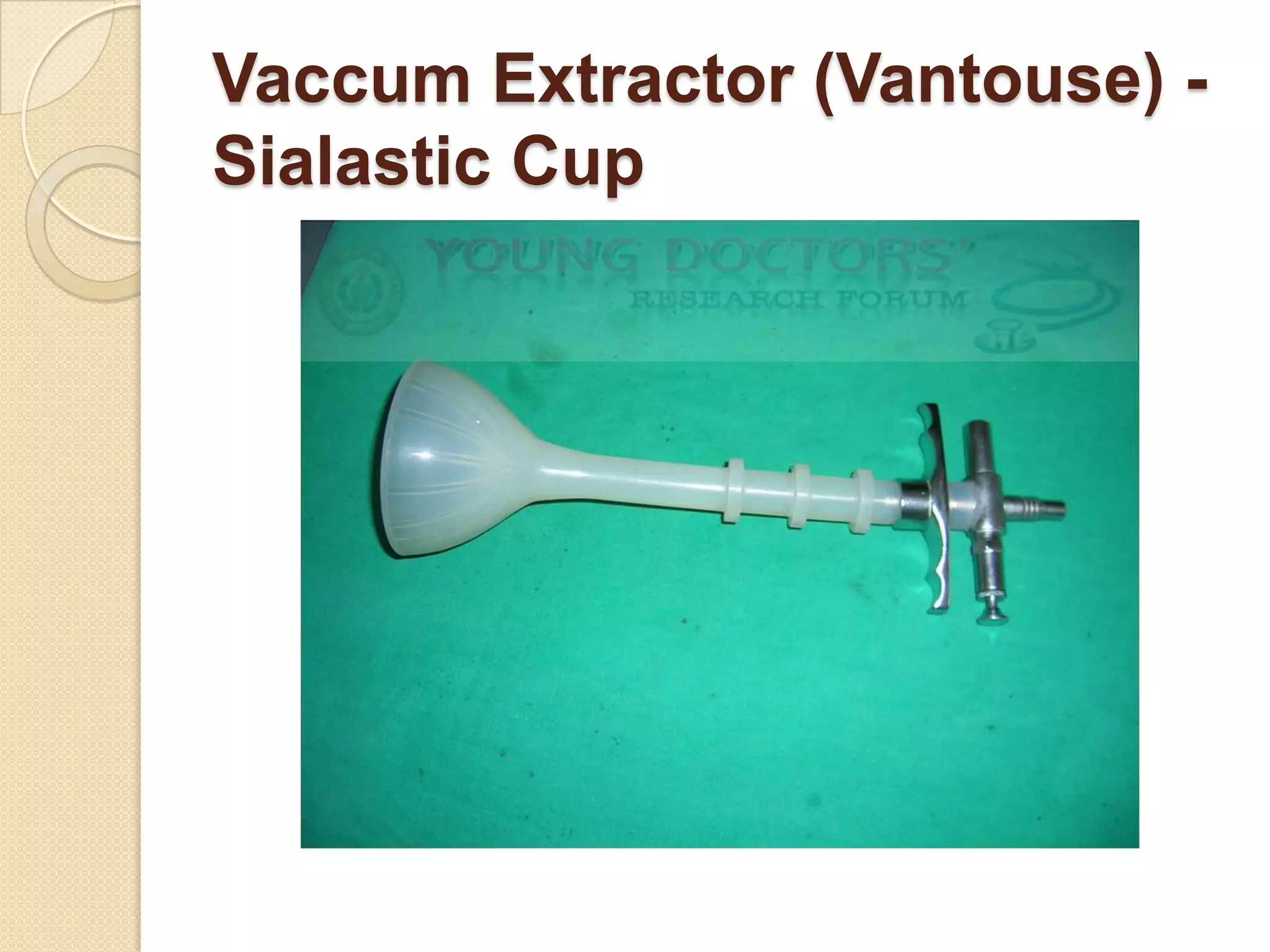 Vaccum Extractor (Vantouse) -
Sialastic Cup
 