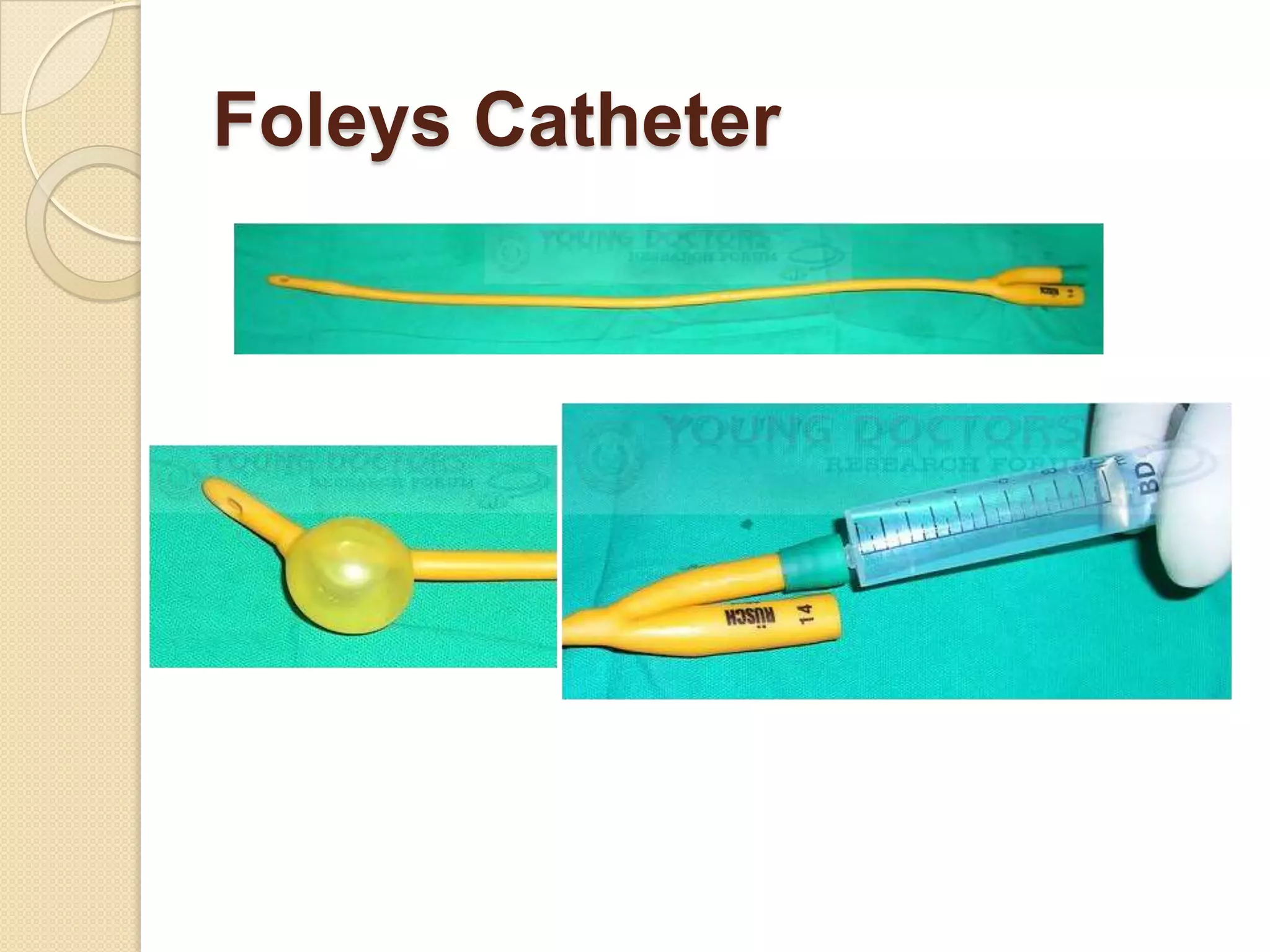 Foleys Catheter
 