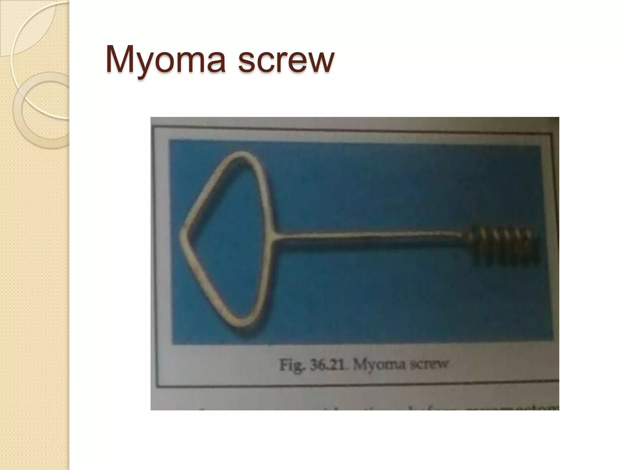 Myoma screw
 