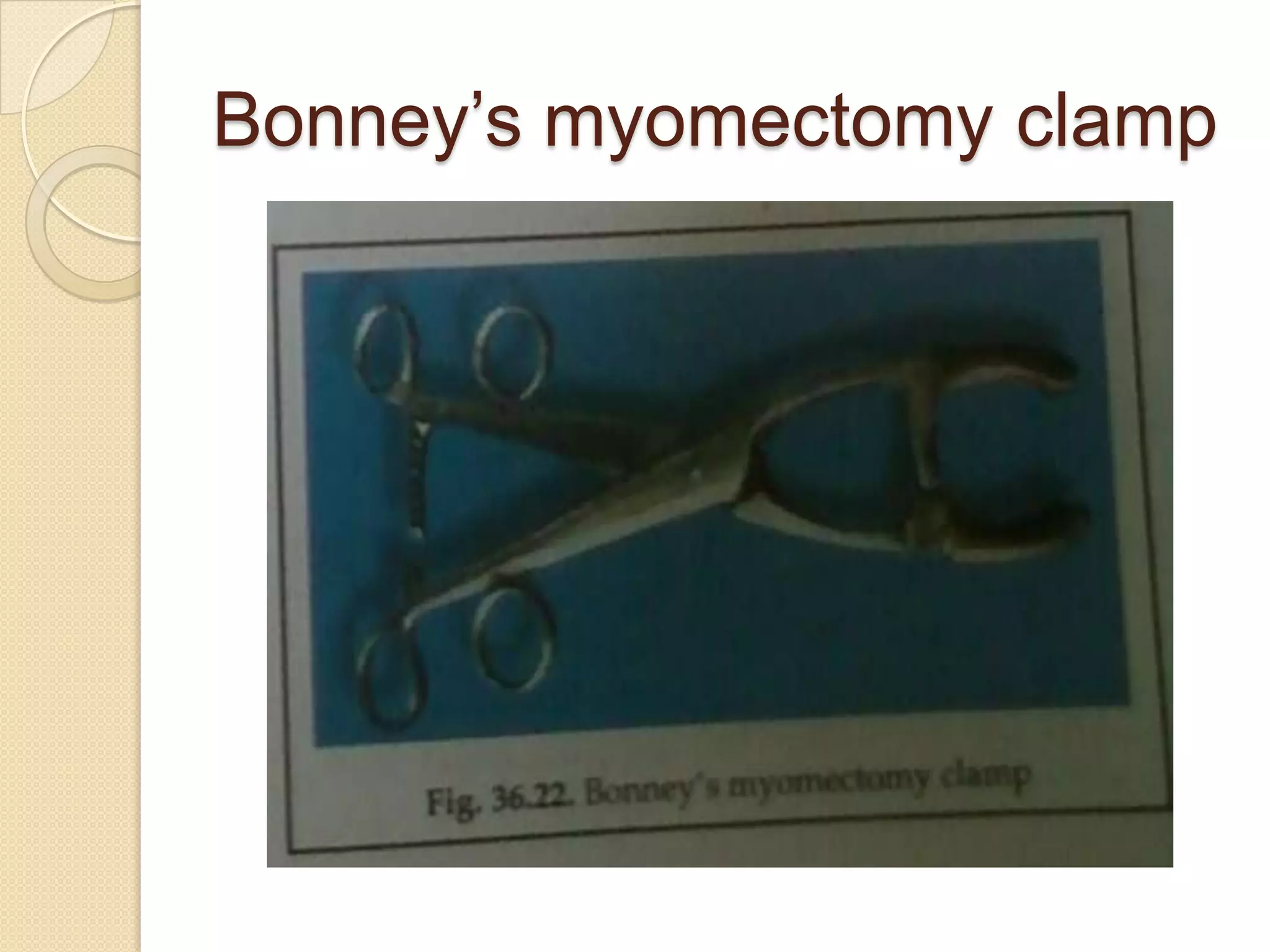 Bonney’s myomectomy clamp
 
