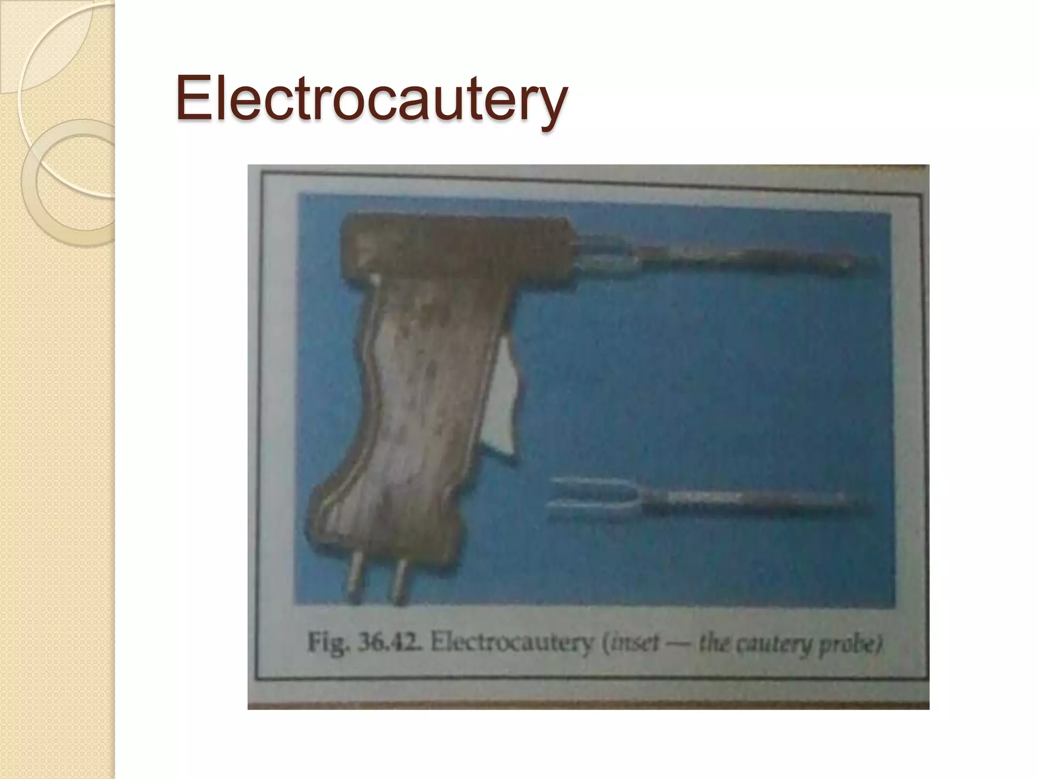 Electrocautery
 