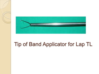 Tip of Band Applicator for Lap TL
 
