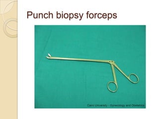 Punch biopsy forceps
 