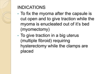 INDICATIONS
• The clamp is used in myomectomy
• It curtails the blood supply to the
uterus temporarily thereby minimising
...