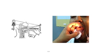 Instruments ent ppt with uses otorhinolaryngology ent | PPTX