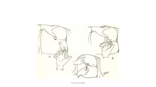 Proctoscope / kellys rectal speculum
•
•
3rdUsed to Visualise anal canal
Procedure
& lower of rectum
• Left lateral / sims position
• Directed 2ward umbilicus
• PR examn b4 proctoscopy
TONY 2010 MBBS
 