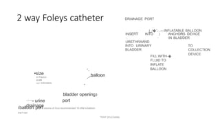 2 way Foleys catheter DRAINAGE PORT
.r::/
j_/�':...---INFLATABLE BALLOON
INSERT INTO
·.
URETHRAAND
INTO URINARY
BLADDER
) ANCHORS DEVICE
IN BLADDER··
TO
COLLECTION
DEVICE
FILL WITH-�
FLUID TO
INFLATE
BALLOON..
..,balloon•size
in French
scale
and milimeters .
bladder opening i
port····- urine
drainagei balloon portvolume of fluid recommended 10 infla1e balloon
mai1<ed
TONY 2010 MBBS
 