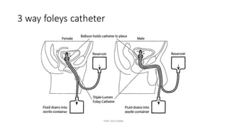 3 way foleys catheter
TONY 2010 MBBS
 