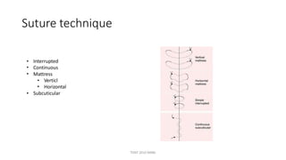 Suture technique
•
•
•
Interrupted
Continuous
Mattress
•
•
Verticl
Horizontal
• Subcuticular
TONY 2010 MBBS
 