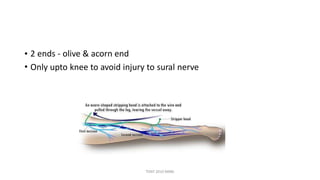 Plastic stripper for varicose vein
TONY 2010 MBBS
 