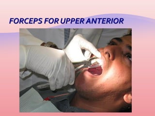 Aufranc Gouges Instruments | PPS