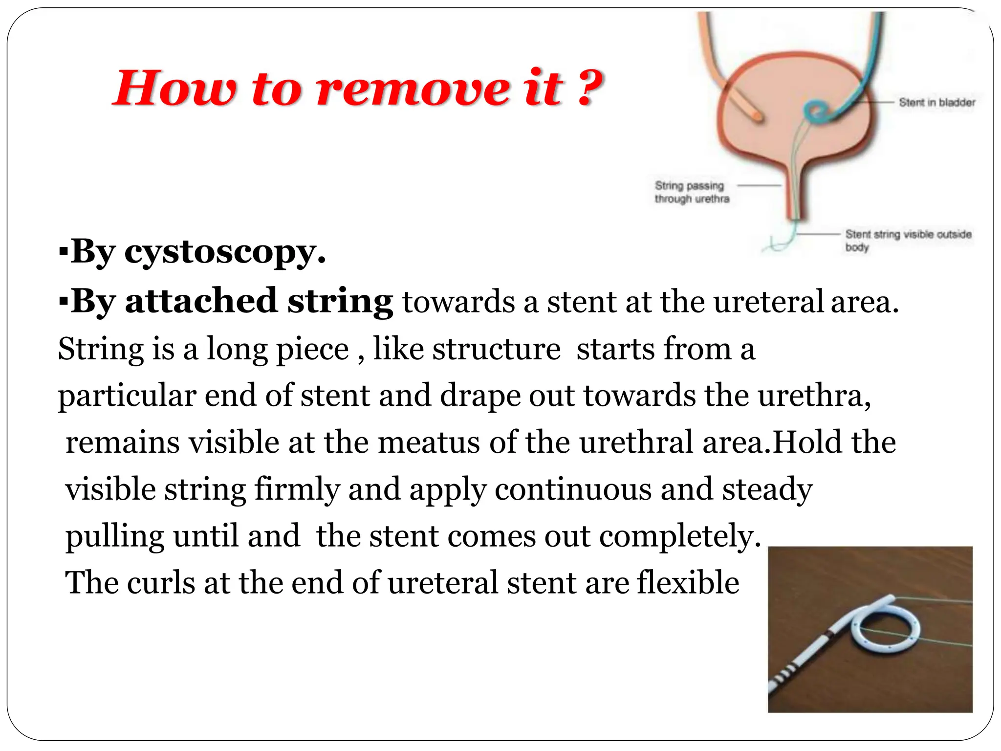 Stent String Urological instruments(uses,indication&contraindication).pptx