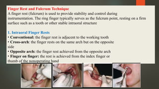Finger Rest and Fulcrum Technique
A finger rest (fulcrum) is used to provide stability and control during
instrumentation. The ring finger typically serves as the fulcrum point, resting on a firm
surface such as a tooth or other stable intraoral structure
1. Intraoral Finger Rests
• Conventional: the finger rest is adjacent to the working tooth
• Cross-arch: the finger rests on the same arch but on the opposite
side
• Opposite arch: the finger rest achieved from the opposite arch
• Finger on finger: the rest is achieved from the index finger or
thumb of the nonoperating hand
 