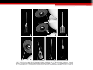 Sepispare Instrument Instrument seperation and its management | PPTX