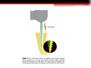 Sepispare Instrument Instrument seperation and its management | PPTX