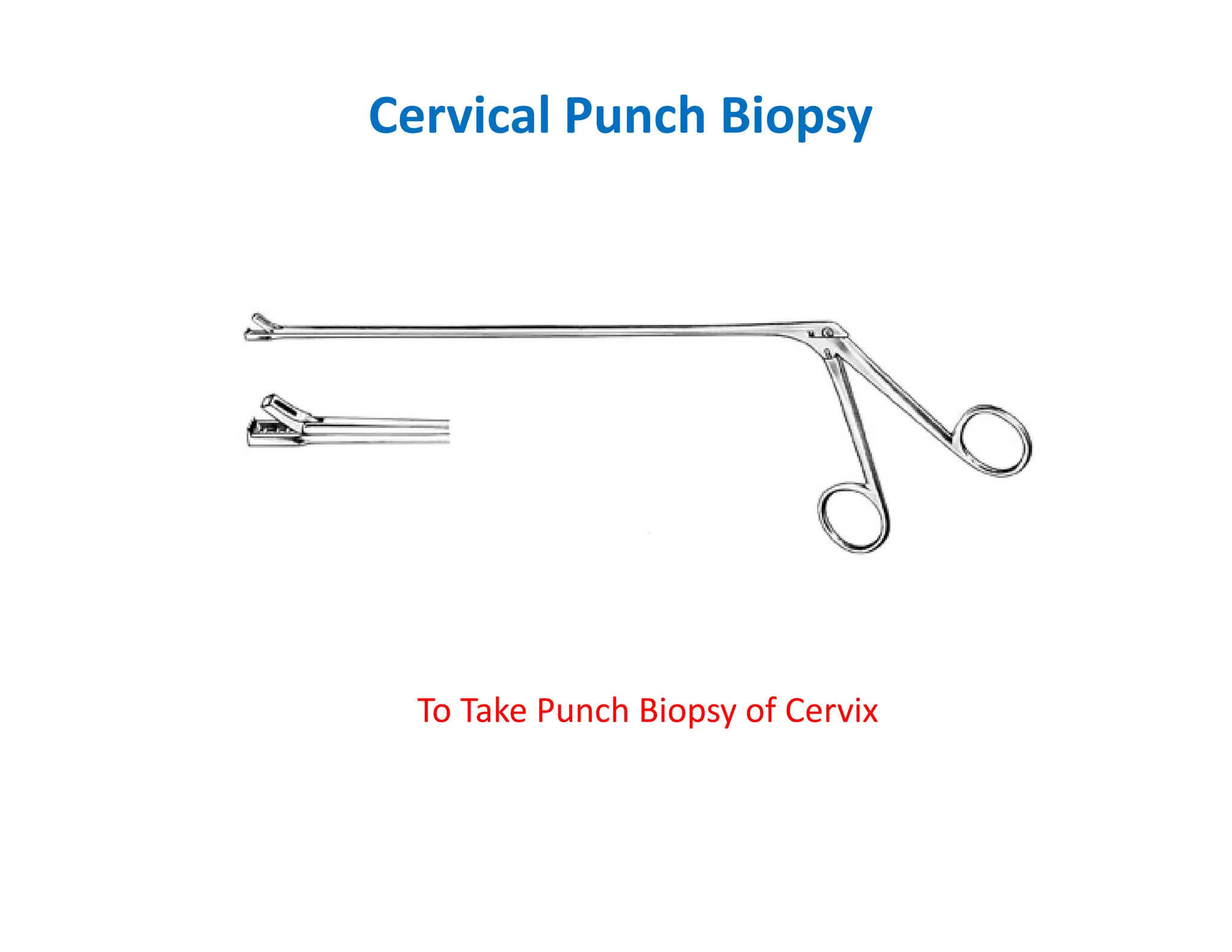 Cervical Punch Biopsy
To Take Punch Biopsy of Cervix
 