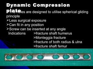 The holes are designed to utilise spherical gliding
principle
Less surgical exposure
Can fit in any position
Screw can be inserted at any angle
Indications >fracture shaft humerus
>Monteggia fracture
>fracture of both radius & ulna
>fracture shaft femur
Dynamic Compression
plate
 