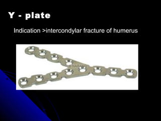 Y - plate
Indication >intercondylar fracture of humerus
 