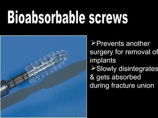 Prevents another
surgery for removal of
implants
Slowly disintegrates
& gets absorbed
during fracture union
 