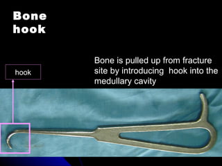 Bone
hook
Bone is pulled up from fracture
site by introducing hook into the
medullary cavity
hook
 