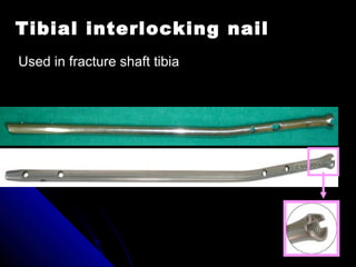 Tibial interlocking nail
Used in fracture shaft tibia
 