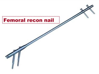 Femoral recon nail
 