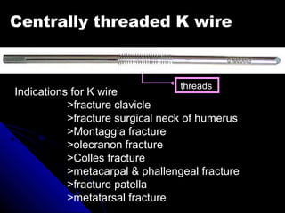 Centrally threaded K wire
threads
Indications for K wire
>fracture clavicle
>fracture surgical neck of humerus
>Montaggia fracture
>olecranon fracture
>Colles fracture
>metacarpal & phallengeal fracture
>fracture patella
>metatarsal fracture
 