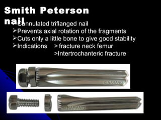 Smith Peterson
nailCannulated triflanged nail
Prevents axial rotation of the fragments
Cuts only a little bone to give good stability
Indications > fracture neck femur
>Intertrochanteric fracture
 