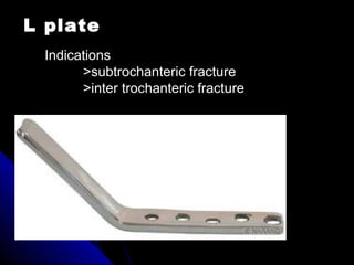 L plate
Indications
>subtrochanteric fracture
>inter trochanteric fracture
 