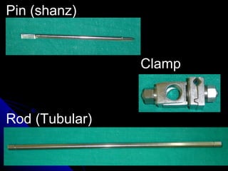 Pin (shanz)
Clamp
Rod (Tubular)
 